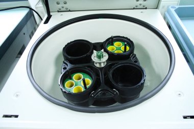 A CENTRIFUGE close-up view