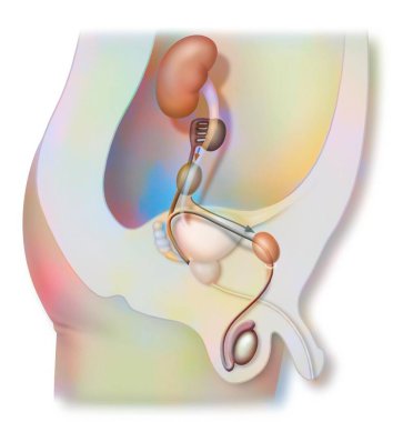 Descent of the testicles: they take the inguinal canal in order to lodge in the scrotal region. 