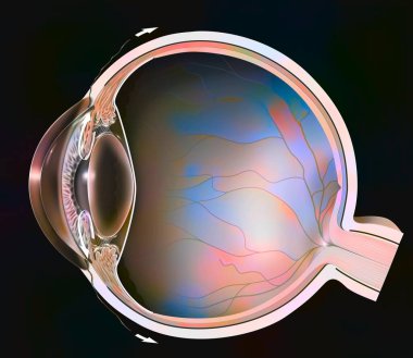 Normal eye with iridocorneal angle showing retina, lens. .