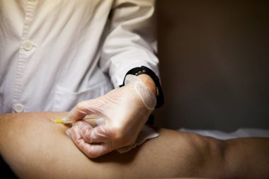 Treatment of cellulite and stretch marks by carboxytherapy, or the subcutaneous injection of carbon dioxide.