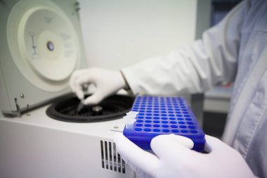 Laboratory analyzes and results to test the effectiveness of an AIDS vaccine.