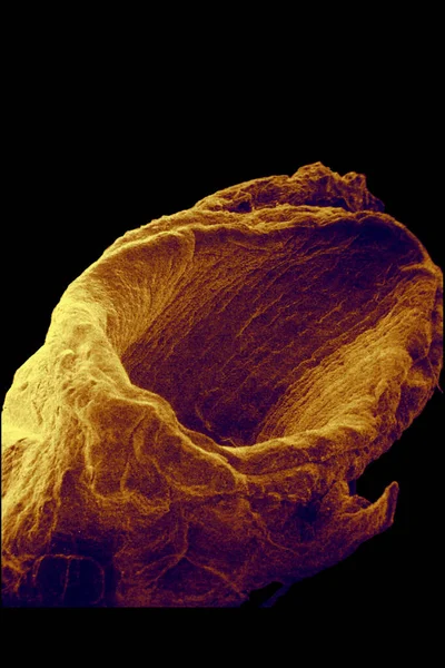 Vein Sem Black Background — Zdjęcie stockowe