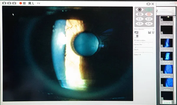 Ophthalmologic Image Ophthalmology Practice Switzerland — Photo