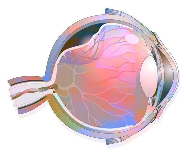 Eye Detachment Retina Which Detaches Underlying Choroid — Fotografia de Stock