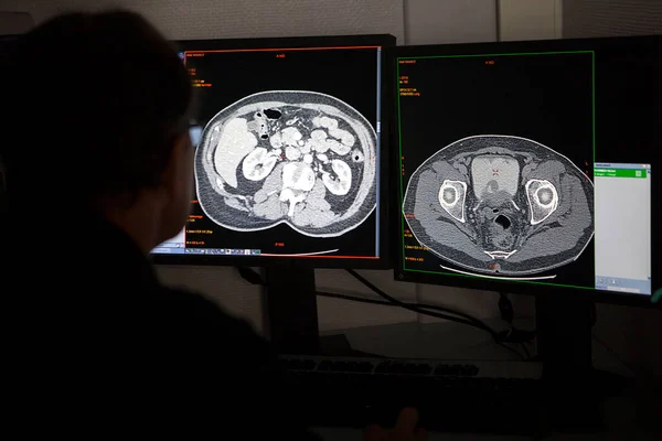 Doctor Analyzing Scan Abdomen Hospital Radiology Department — Stock Photo, Image