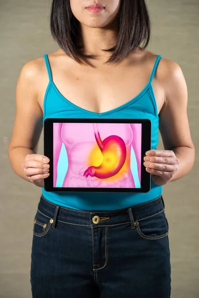 Woman Holding Screen Drawing Stomach Gastric Ulcer —  Fotos de Stock