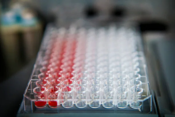 Hematology Laboratory Blood Group Determination Blood Samples — Zdjęcie stockowe