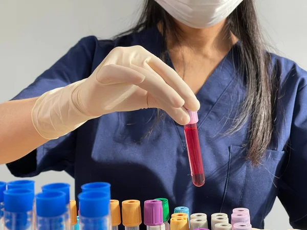 Serological Test Done Blood Test Look Presence Antibodies Virus — Stockfoto