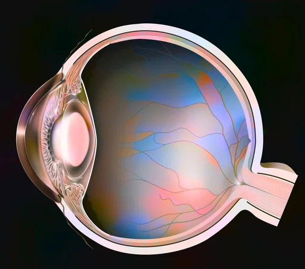 Eye Clouding Lens Event Nuclear Cataracts — Foto Stock