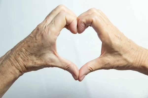 One Hand Spots Old Age Other One Laser Treated — Stock fotografie