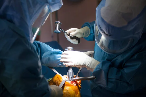 Orthopedic surgery operating room for total knee replacement, surgeons and instruments.