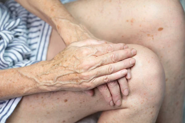 Hands Spots Old Age — Stockfoto