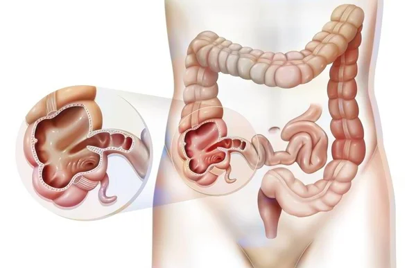 Colon Large Intestine Zoom Cecum — Stok fotoğraf