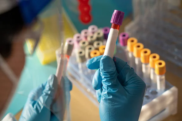Laboratory Technician Performing Blood Tests Laboratory — Stockfoto