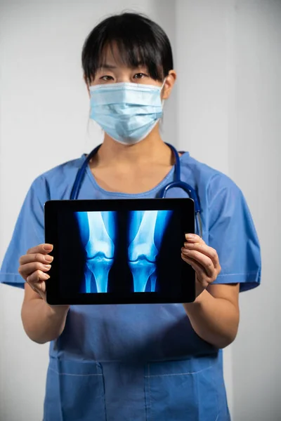 Female Doctor Holding Screen Ray Lungs — Stock fotografie