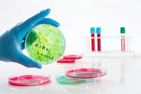 Zika Virus Analysis Concept — Fotografia de Stock