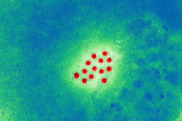Hepatitis Virus Abstract Background — 图库照片