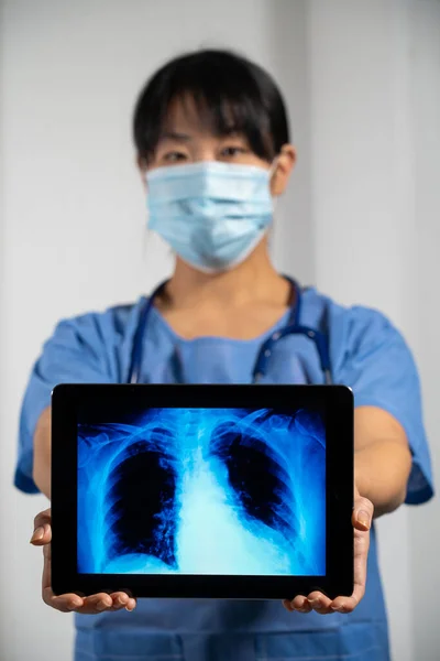 Female Doctor Holding Screen Ray Lungs — Stok Foto