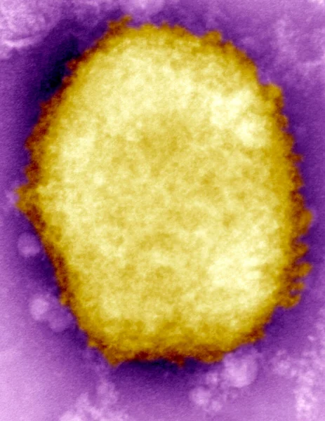 Monkeypox Virus Present Human Vesicular Fluid Here Negative Stain Electron — Zdjęcie stockowe