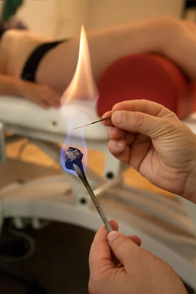 Therapist Specializing Traditional Chinese Medicine Practicing Acupuncture Moxibustion — Foto Stock