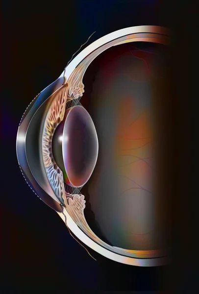 Eye Surgery Refractive Photokeratectomy Case Hyperopic Eye — Foto Stock