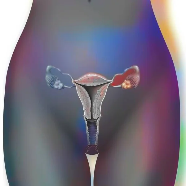 Anterior View Female Genitalia Vagina Uterus Tubes Ovaries — Zdjęcie stockowe