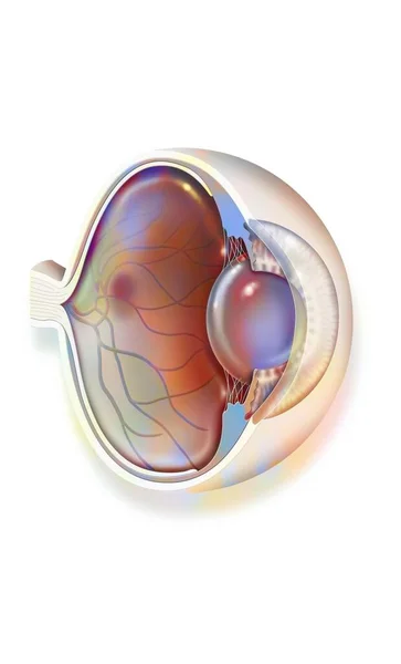 Cutaway Eye Macular Degeneration Opaque Red Spot Macula — ストック写真