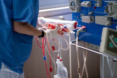 Hemodialysis in the nephrology department of a day hospital, nurse holding the dialyzer.