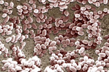 Listeria ivanovii. Scan electron micrography.