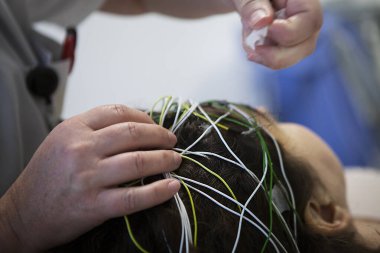 Reportage in a functional neurological exploration unit. Epilepsy screening and follow-up consultation. The patients take a video EEG (electroencephalogram), during which they are subjected to various stimuli, both auditive and visual. The patterns a