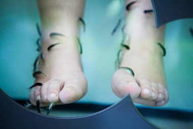 Garra rufa fish feed on dead skin and are used to treat wounds or psoriasis.