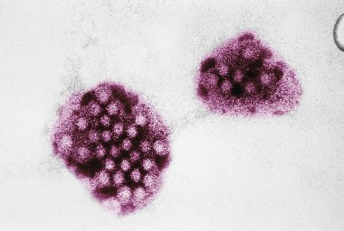 NORWALK VIRUS close-up background 