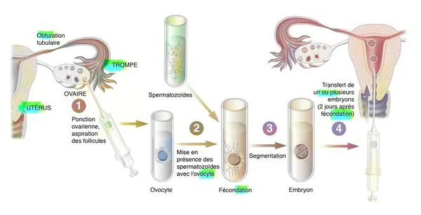 Diagram Different Stages Vitro Fertilization — ストック写真