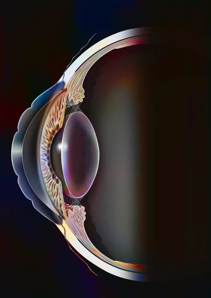 Eye Presbylasik Application Lasik Correction Presbyopia — Zdjęcie stockowe
