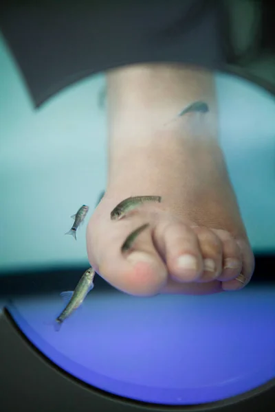 Garra Rufa Ψάρια Τρέφονται Νεκρό Δέρμα Και Χρησιμοποιούνται Για Θεραπεία — Φωτογραφία Αρχείου