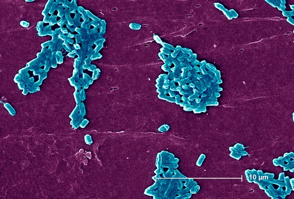 Цей Скануючий Електронний Мікрограф Sem Зображує Ряд Паличкоподібних Бактерій Escherichia — стокове фото