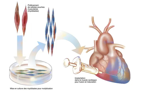 Culture Muscle Stem Cells Implantation Heart Muscle — Stockfoto