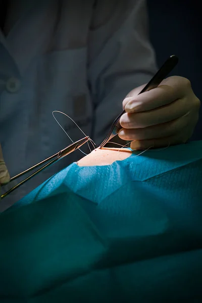Stitches Removal Cyst Dermatologist — Stockfoto