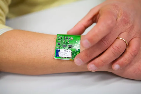 Monitoring Human Metabolism Implant Equipped Bio Sensors Capable Detecting Molecules — 图库照片