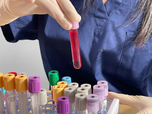 Serological Test Done Blood Test Look Presence Antibodies Virus — Stockfoto