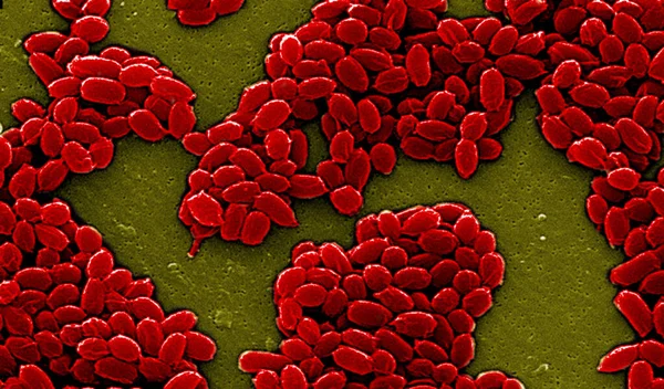 Anthrax Bacterium Spore Sem — Zdjęcie stockowe