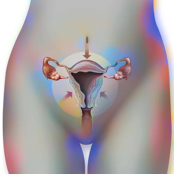 Retraction Uterus Severed Childbirth Remove Bleeding — Foto Stock