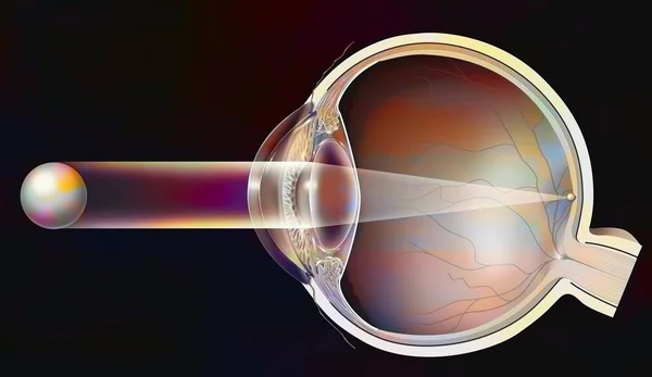 Normal Vision Healthy Eye Image Forms Retina — Foto Stock