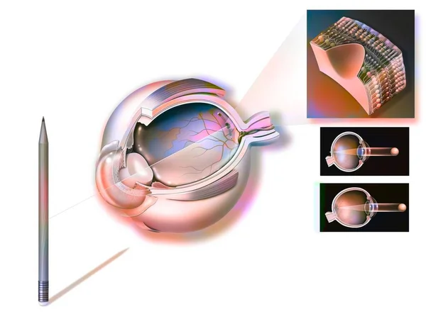 Eye Visualized Image Refracted Lens Cornea Retina — Stock Photo, Image