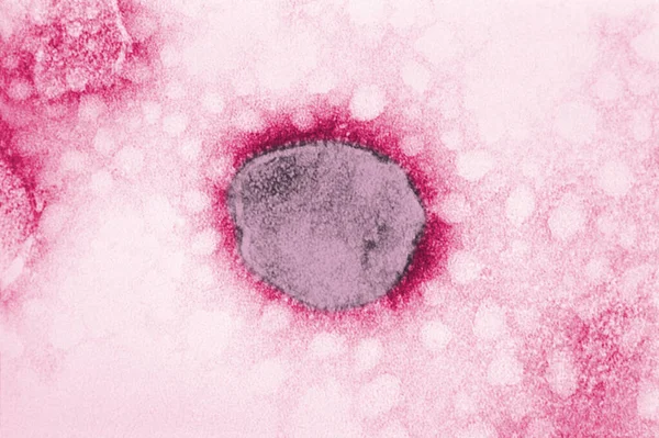 Tacaribe Virus Medical Background — Foto de Stock