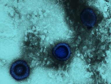 This transmission electron micrograph from a pelleted specimen depicts three icosahedral-shaped herpes virus virions. The staining technique used to process this specimen revealed the following findings: virions with a dark center, where the stain ha