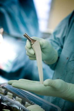 Femoral stem of the hip prosthesis which will be placed on a patient undergoing orthopedic surgery.
