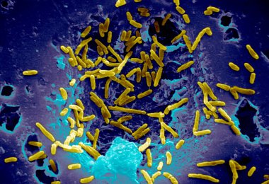 Scanning Electron Micrograph of Mycobacterium chelonae. clipart