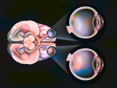 Eye: path of the visual pathways from the eye to the visual areas of the brain.