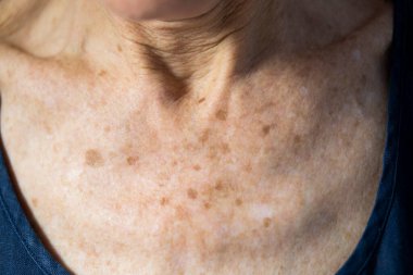 Neck of old woman